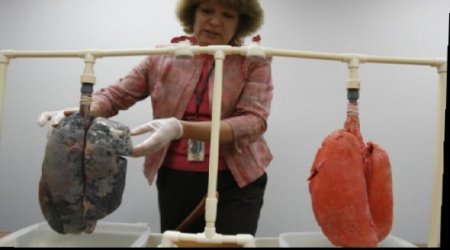 Smokers vs Normal Lungs - VIDEO