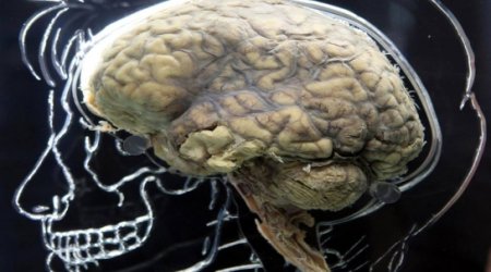 Scientists developed an “off-switch” for the brain