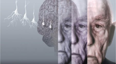 Dementia Facebook app to raise awareness of the illness