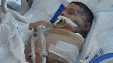 Mexican boy is recovering after watermelon-sized tumor is removed - VIDEO