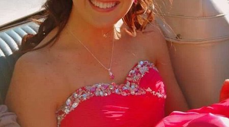 Teenager whose skin 'burnt from the inside out'