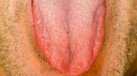 What does your tongue say about your health?