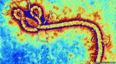 Ebola vaccine trial 'interrupted' due to joint pains