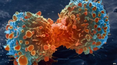 Most cancer types 'just bad luck'