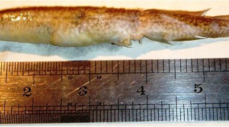 Teenager has 6-inch live EEL gets stuck in his throat for five hours