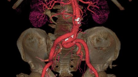 Brains, veins and bones as you've never seen them