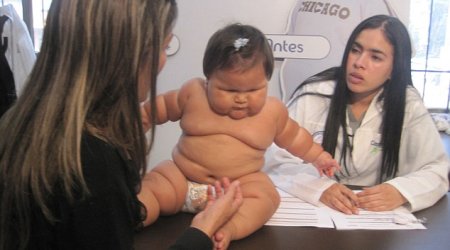 The 10-month-old who weighs as much as a five-year-old
