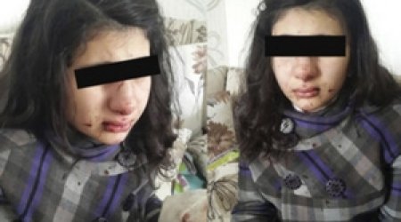 Bakıda manyak məktəbli qızı döydü - FOTO
