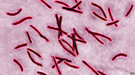 Call to boost antibiotics funding to tackle 'looming crisis'