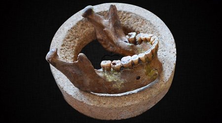 How the dawn of farming ruined our TEETH