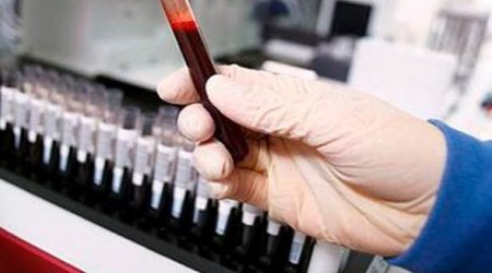 Azərbaycanda talassemiya xəstəliyinin ən çox yayıldığı rayonlar