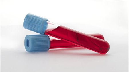 Rapid blood test to 'cut antibiotic use'