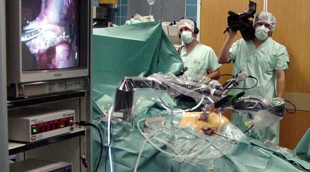 Google to develop robo-surgeons