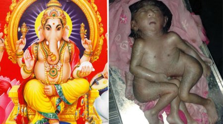 Baby born with EIGHT limbs worshipped as 'Hindu God'