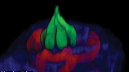 Lasers reveal what taste LOOKS like