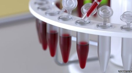 Blood test 'boost' in ovarian cancer fight
