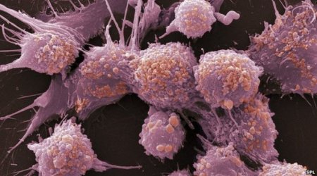 Prostate cancer gene map points way to targeted drugs
