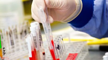 Azərbaycanda ilk: Hemofiliyalı xəstələr üçün Reabilitasiya Mərkəzi yaradılır