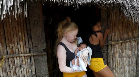 Albino youngsters are forced to stay out of the bright sun in Panama village