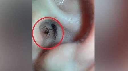 Черная вдова в ухе