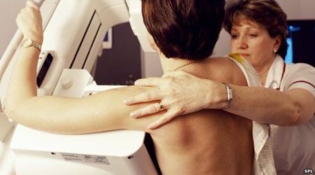 Breast cancer warning to older women