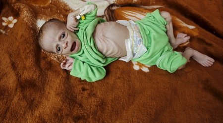 Heartbreaking images reveal the human face of hunger in Yemen