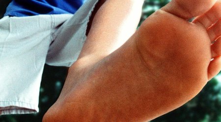 The disgusting secrets of smelly feet