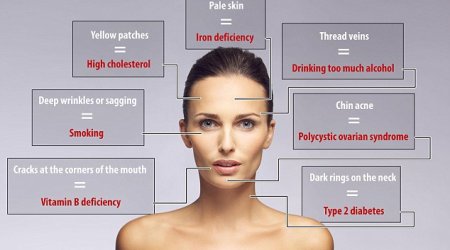 What your FACE says about your health