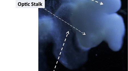 The brain grown in a LAB