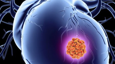 Patch may boost repair after heart attack
