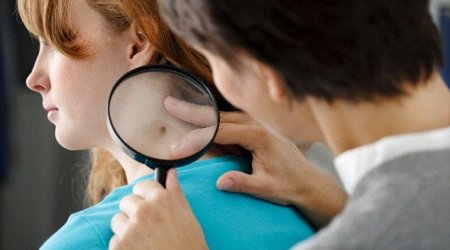 Revealed.. the top 5 warning signs of cancer in young people