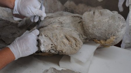 Ancient Pompeiians had surprisingly good teeth