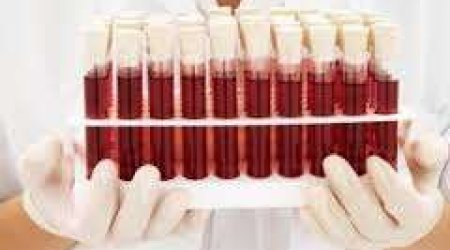 Hemofiliyalı xəstələr tam sağala bilərlər