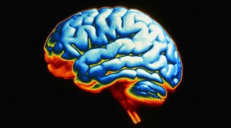 How healthy is YOUR brain?