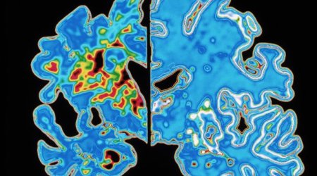 Virtual reality maze 'predicts Alzheimer's disease'