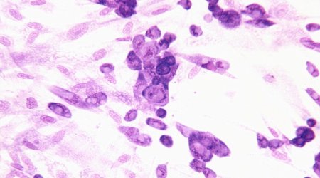 Nasa's $80,000 HERPES study