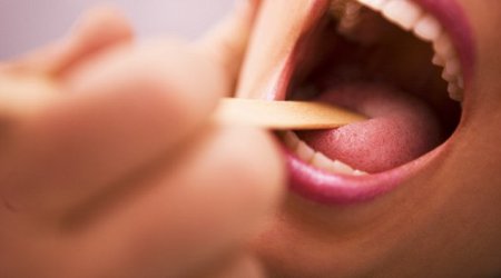 Could tonsil ops for kids cut cancer rates?