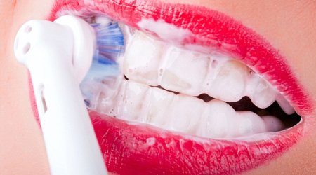 How your electric toothbrush can DESTROY your teeth