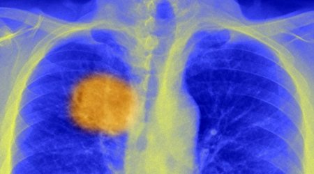 Scientists 'find cancer's Achilles heel'