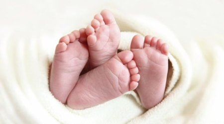 Vietnam twins found to have different fathers in rare case