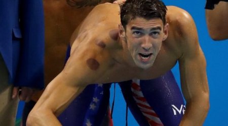 Why are so many Olympians covered in large red circles?