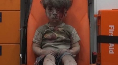 Little boy in Aleppo a vivid reminder of war`s horror