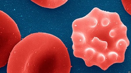 Malaria stopped with single dose of new compound