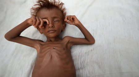 Risk of famine looms in Yemen