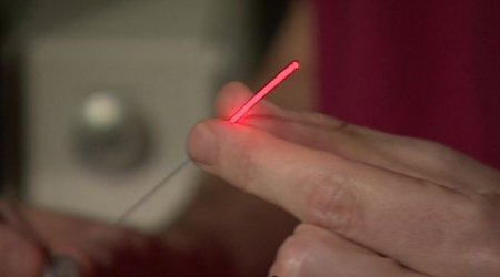 Prostate cancer laser treatment 'truly transformative'