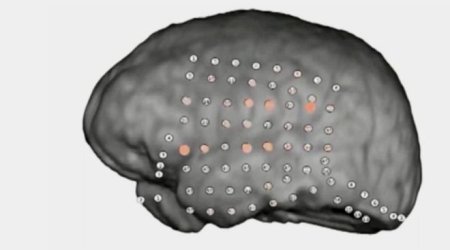 Brain's party noise filter revealed by recordings