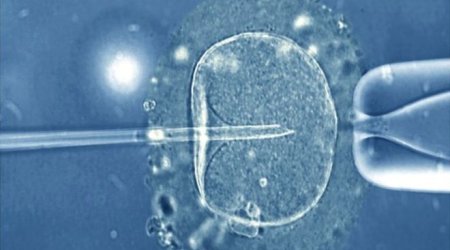 Three-person IVF baby for infertile couple