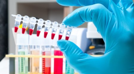 Azərbaycanda idmançının qanında morfin aşkarlanıb