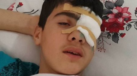  Bakıda 10-cu sinif şagirdi gözündən güllələndi – FOTO
