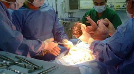 Qəza zamanı 20 yarımçıq doğulmuş uşaq olub